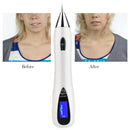 LED Mole Removal Pen Handheald Pen Scar Tattoo Removal Melanine Diluting Device Spot Removal