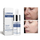 LANBENA Hyaluronic Acid Serum Snail Essence Moisturizing Acne Treatment Repair Anti-Aning Winkles