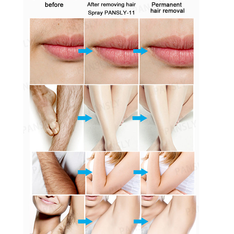 20ml Natural Sprayer & Wipe Hair Removal Spray Away Painless Hair Remover Body Care