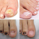 Nail Pen Nutrient Solution Remove Nail Fungus Antibacterial Repair Liquid Brighten Nail Pen