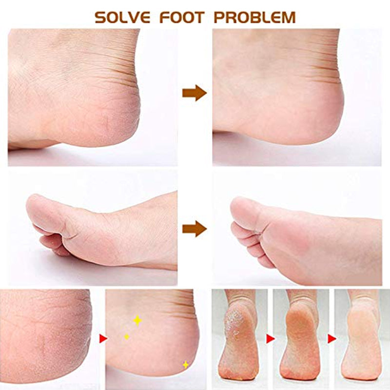 8-in-1 Foot Plate Honing Foot Stone Grinding Foot Skin Squeegee to Dead Skin non-Electric Pedicure Tool Repair Planing Knife Set