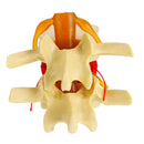 Anatomical Human Skeleton Spine Lumbar Vertebrae Degenerative Disc Medical Model
