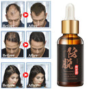30ml Hair Growth Essence Preventing Hair Loss Hair Care Essential Treatment Liquid Hair Scalp Care