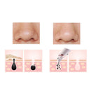 Electric Blackhead Remover Absorbing Pore Cleansing Acne Suction Machine Skin Facial Care