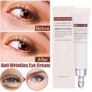 20g Best Eye Cream Serum For Dark Circles Puffiness Under Eye Reduce Fine