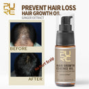 20ml Hair Growth Treatment Hair Loss Spray Hair Essence Oil