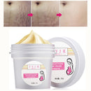 Stretch Mark Removal Cream Postpartum Scar Obesity  Mask Powerful  Scar  Removal Cream