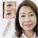 Eye Delight Boost Serum Essence Anti Puffiness Dark Circle Wrinkle Remover Cream