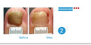 Lian Biquan Nail Repair Nail Polish Repair