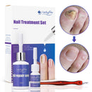 LuckyFine Toenail Fungus Treatment Set Onychomycosis Gel Nail Repair Serum Nail Care Tool