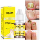 OEDM Nail Treatment Onychomycosis Paronychia Anti Fungal Nail Infection Toe Nail Fungus Treatment