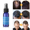 Okeny's Brand Yuda Pilatory Stop HairLoss Fast Hair Growth Spray Liquid Hair Essence