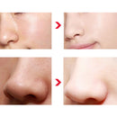 Sherman to Blackhead Acne Cleansing Moisturizing Black Frozen Film