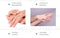 Lian Biquan Nail Repair Nail Polish Repair