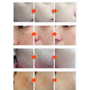12 DAYS EFFECT! KMELE Day & Night Scar Removal Cream Face Anti Freckle Brighten Whitening US