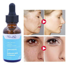 Lactic Acid Solution Essence Hyaluronic Acid Exfoliating Moisturizing Facial Essence Lactic Acid