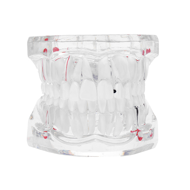 Clear Dental Teeth Study Teaching Model Crystal Typodont Model Removable Teeth Model Medical Model