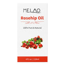 Organic Rosehip Oil 4 oz Skin Care Moisturizer Scar Removal Facial Acne Essential Oil