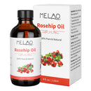 Organic Rosehip Oil 4 oz Skin Care Moisturizer Scar Removal Facial Acne Essential Oil