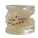 Teeth Orthodontic Model Self-ligating Bracket Straight Edgewise Bracket 90Ã—70Ã—60mm For Teaching Education