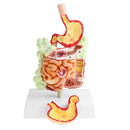 Minification 1X Human Large Intestine Stomach Pathological Model School Teaching Display Lab Supplies