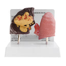 Minify 1x Human Lung Normal & Pathological Comparison Lab Demonstration Model Kits Learning Resources