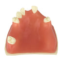 Upper Jaw Sinus Lift Implants Restoration Tooth Practice Model Dental Mold 2.36Ã—2.36Ã—1.57 inch