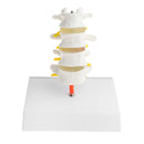 1:1 Human 4 Lumbar Vertebrae Intervertebral Disc Skeleton Model School Teaching Display Lab Supplies