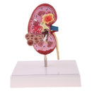 2-Sided Kidney Anatomical Model with Stand Nephropathy Statue Human Organ Learning Tool Lab Supply Science Educational Toy