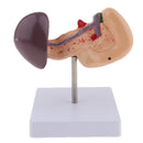 Premium Life Size Anatomical Pancreas, Duodenum, Spleen Model With Base - Human Anatomy