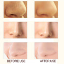 Electric Blackhead Remover Pore Vacuum Suction Diamond Dermabrasion Face