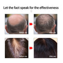 20ml Fast Powerful Hair Growth Care Essential Oil Liquid Hair Loss Treatme EVN