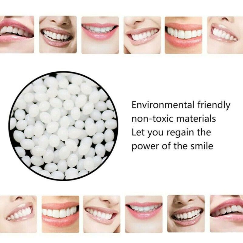 100g Temporary Tooth Filling Material Temp Replace Missing Teeth Repair  YKO
