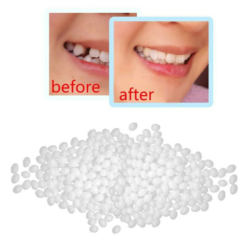 100g Temporary Tooth Filling Material Temp Replace Missing Teeth Repair  NFU