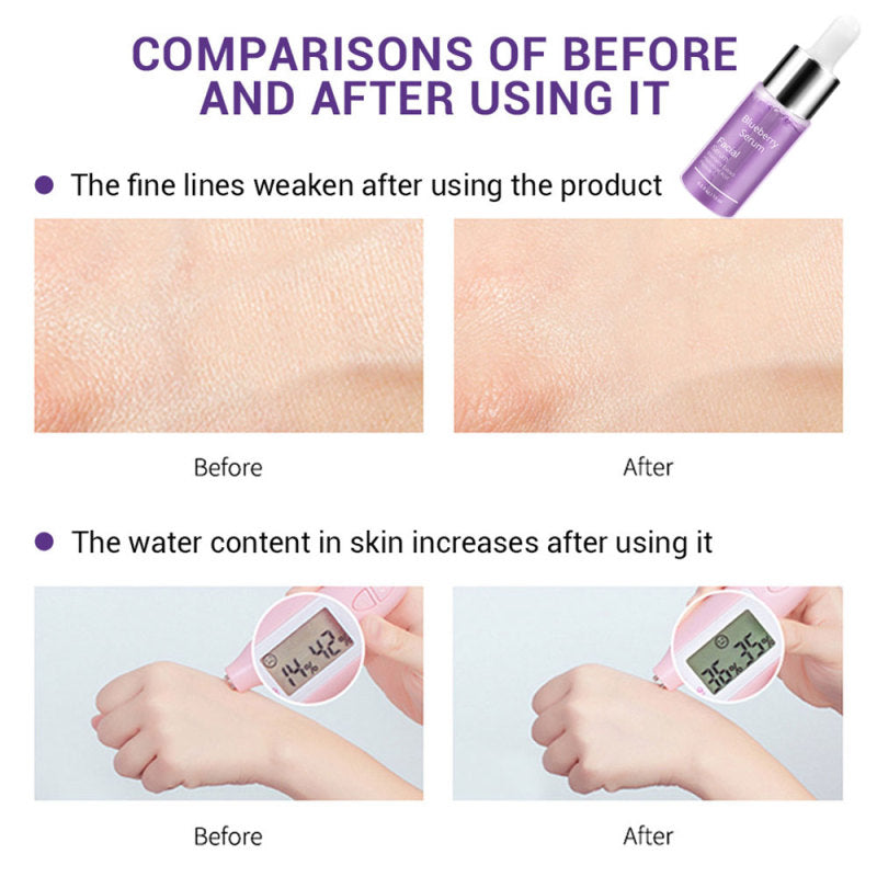 Unisex Blueberry Hyaluronic Acid Serum Essence Oil Facial Moisturizing Whitening