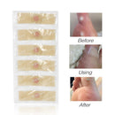 12pcs/set Foot Care Stickers Medical Plaster Chicken Eye Corns Patches Newly