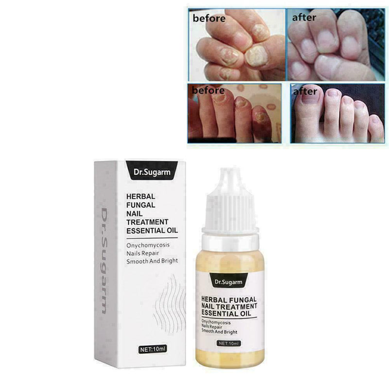 Nail Fungus Treatment Nail Oil Pen Anti Fungal Nail Remove Q4Y8 L0J1 C8K4