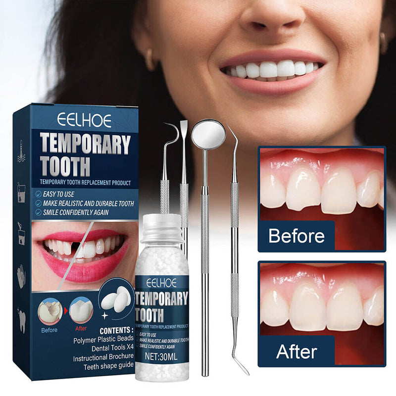 Tooth Filling Repair Beads for Missing Broken Teeth Strong Abrasion Resista
