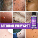 Wart Treatment Liquid Anti Verruca Remedy Warts Remover Removing Against Moles