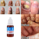 Anti Fungal Treatment Fungus Effective Finger Toe Nail Repair Liquid Solu F7X0
