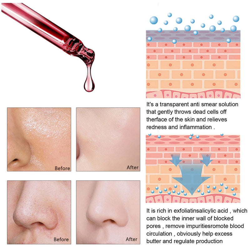 Exfoliating Pores Repair Fruit Acid Shrink Pores Skin Care Salicylic Acid
