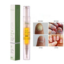 Oils Moisturizing Enhance Damaged Cuticles Nail Repair Oil Nail Cuticle Care