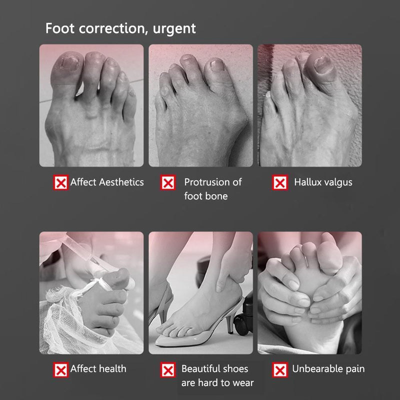Bone Thumb Adjuster Pedicure Toe Straightener Orthotics Foot Care Feet Prot