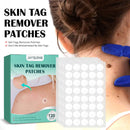 120pcs Skin Tag Remover Patch Maintenance Treatment Stickers Quick Absorb Plaster Tools
