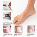 10pcs Ingrown Toenail Straightening Clip Curved Brace Toenails Correction