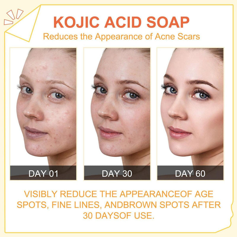 Papaya Kojic Acid Soap Deep Cleansing Softening Cuticle Lightening Melanin{