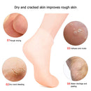 1 Pair Foot Care Socks Moisturizing Gel Cracked Skin Protectors Socks (M) Newly