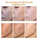 Orange Whitening Facial Soap Handmade Bleaching Face S7S4 S4O6