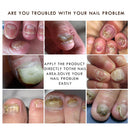 Ginger Nail Treatment Serum Hand and Foot Absorb Nutrients for Growing Heal