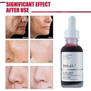 Salicylic Acid Shrink Exfoliating Smooth Pores Repair Essence Skin Care~